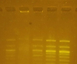 Transilluminator for DNA Gel Electrophoresis