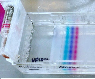 DIY Simple & Cheap Electrophoresis Setup for DNA Separation