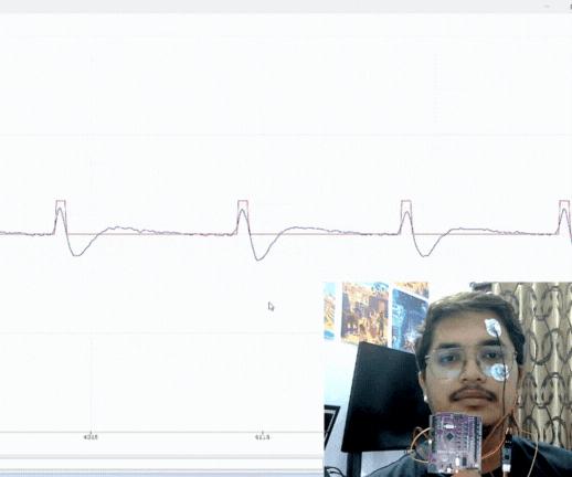 Eye Blink Detection by Recording EOG Using BioAmp EXG Pill