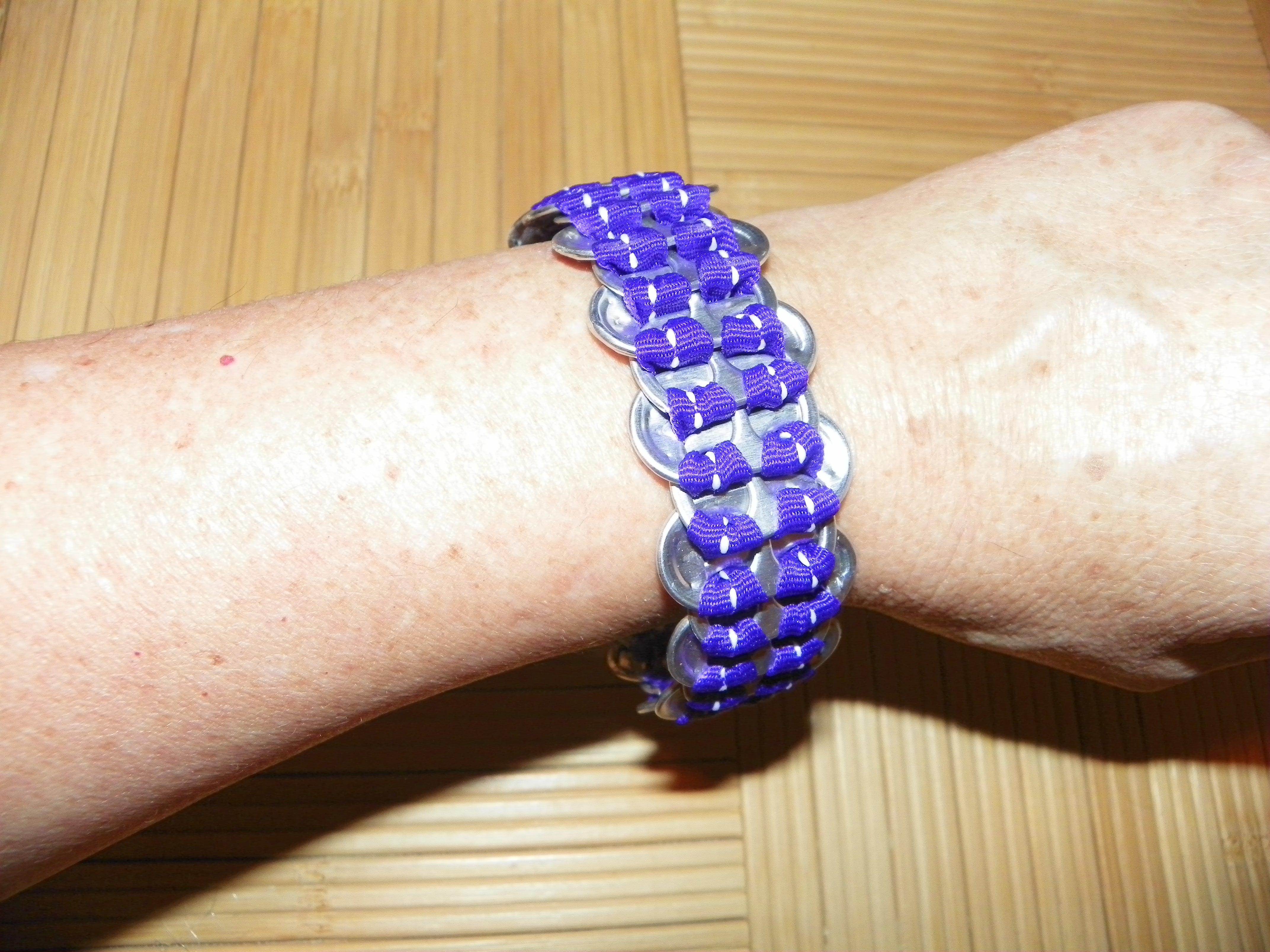 Pop-Top Bracelet