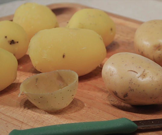 How to Easily Remove Potato Skins