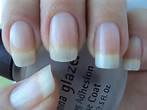 How to Get Beautifull Nails and Cuticles Instantally!