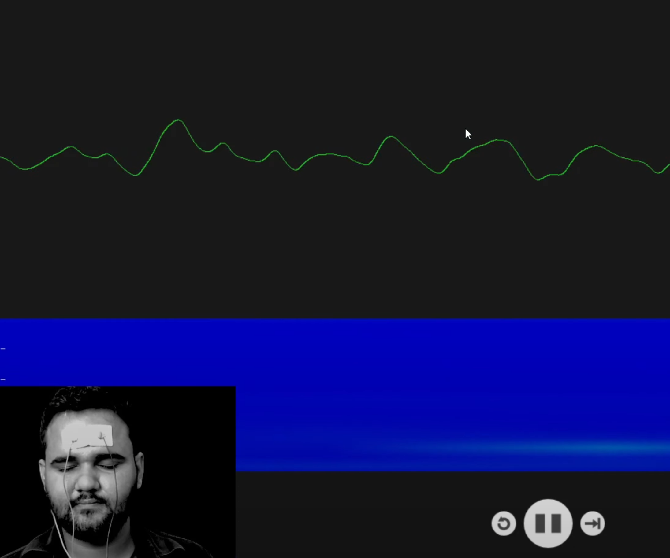 Recording EEG From Pre Frontal Cortex of Brain Using BioAmp EXG Pill