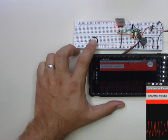 Visualize Cardiac Graphics on Smartphone With Cheapduino and Pulse Sensor