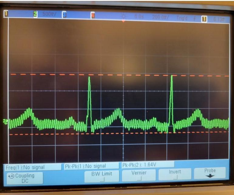 Breadboard ECG