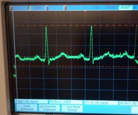 Arduino Display of Filtered ECG Signal