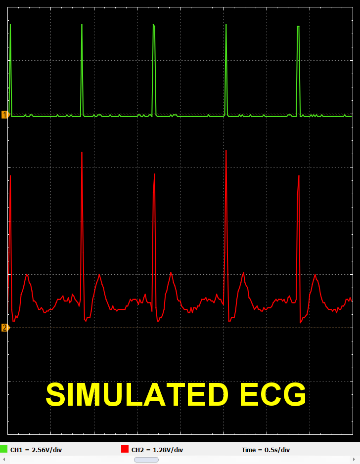 0.8Hz_ecg_sshot195401.png