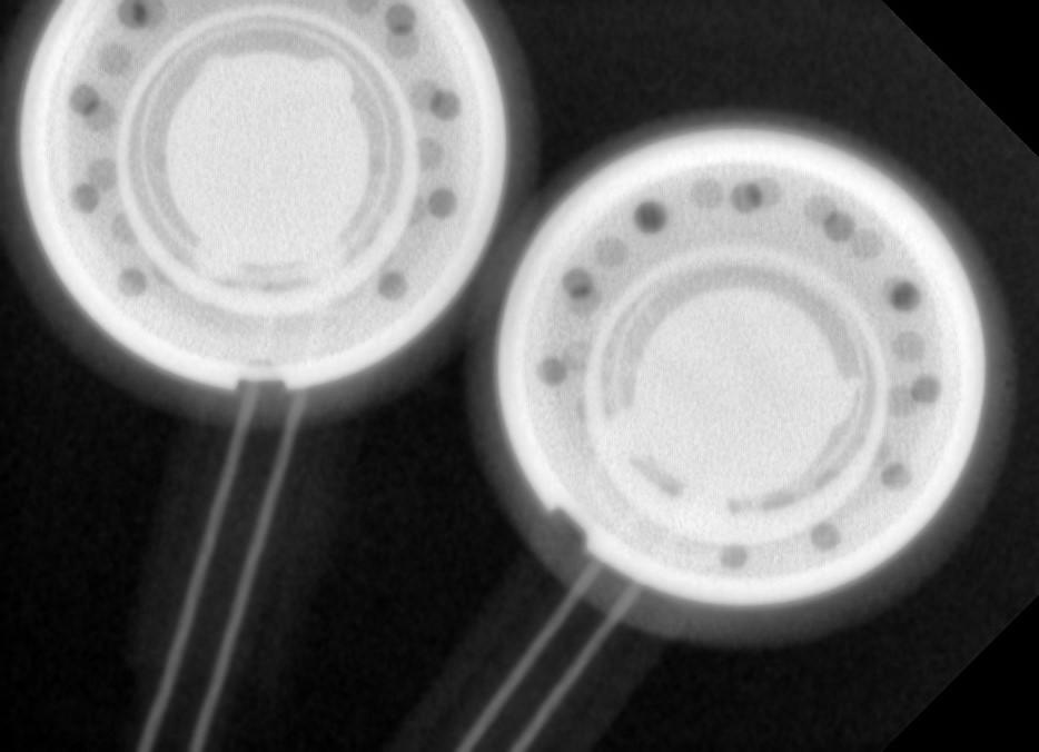 03_XRay.jpg