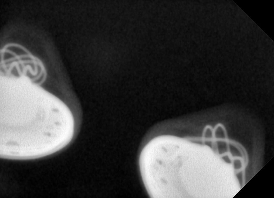 04_XRay.jpg