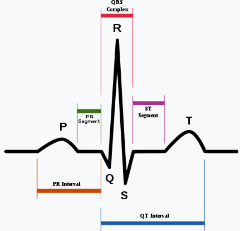 207.ECG_Sample.PNG