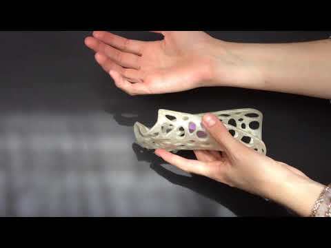 3D Printed Wrist Orthosis