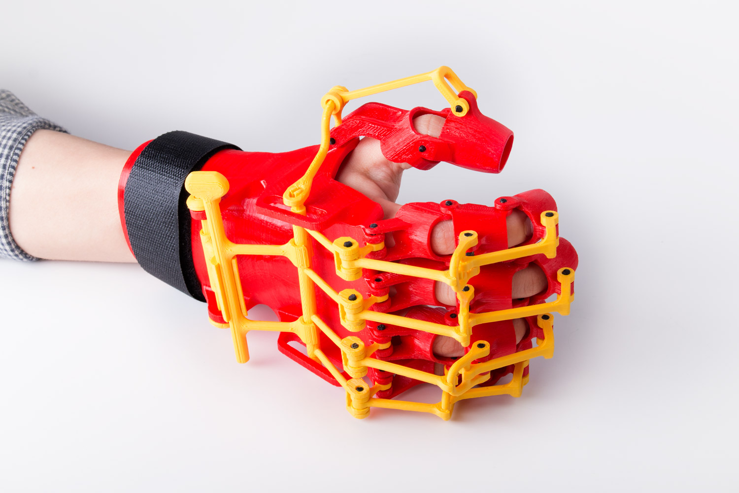 3D_Printed_Rehabilitation_Orthosis_Design_03.jpg