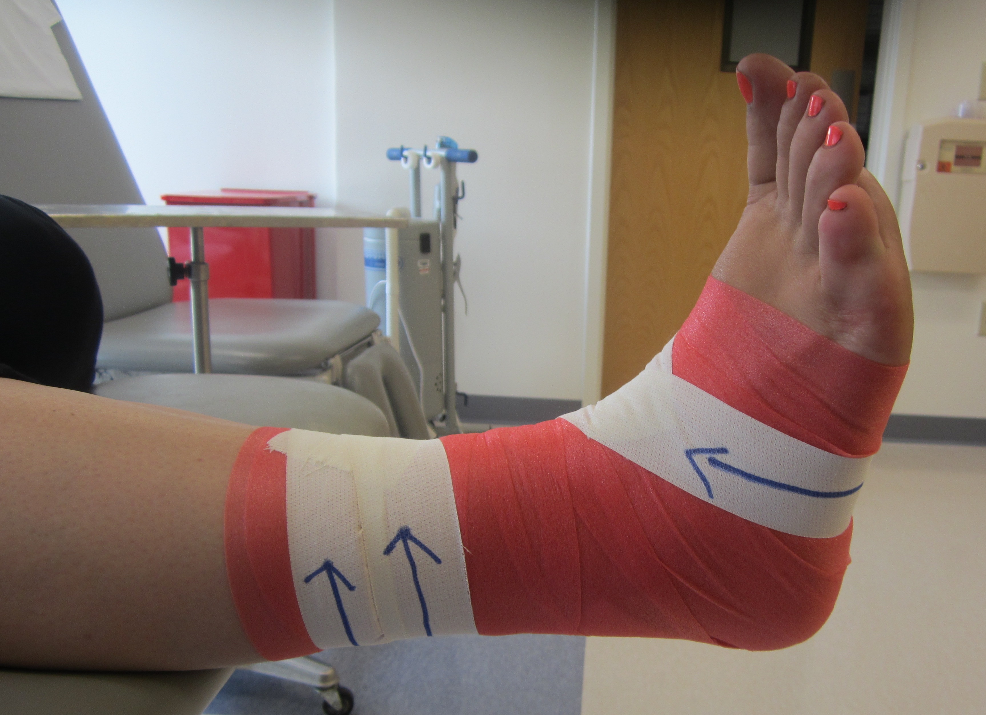 4_Ankle_Taping_Anchors_8.12.14.JPG