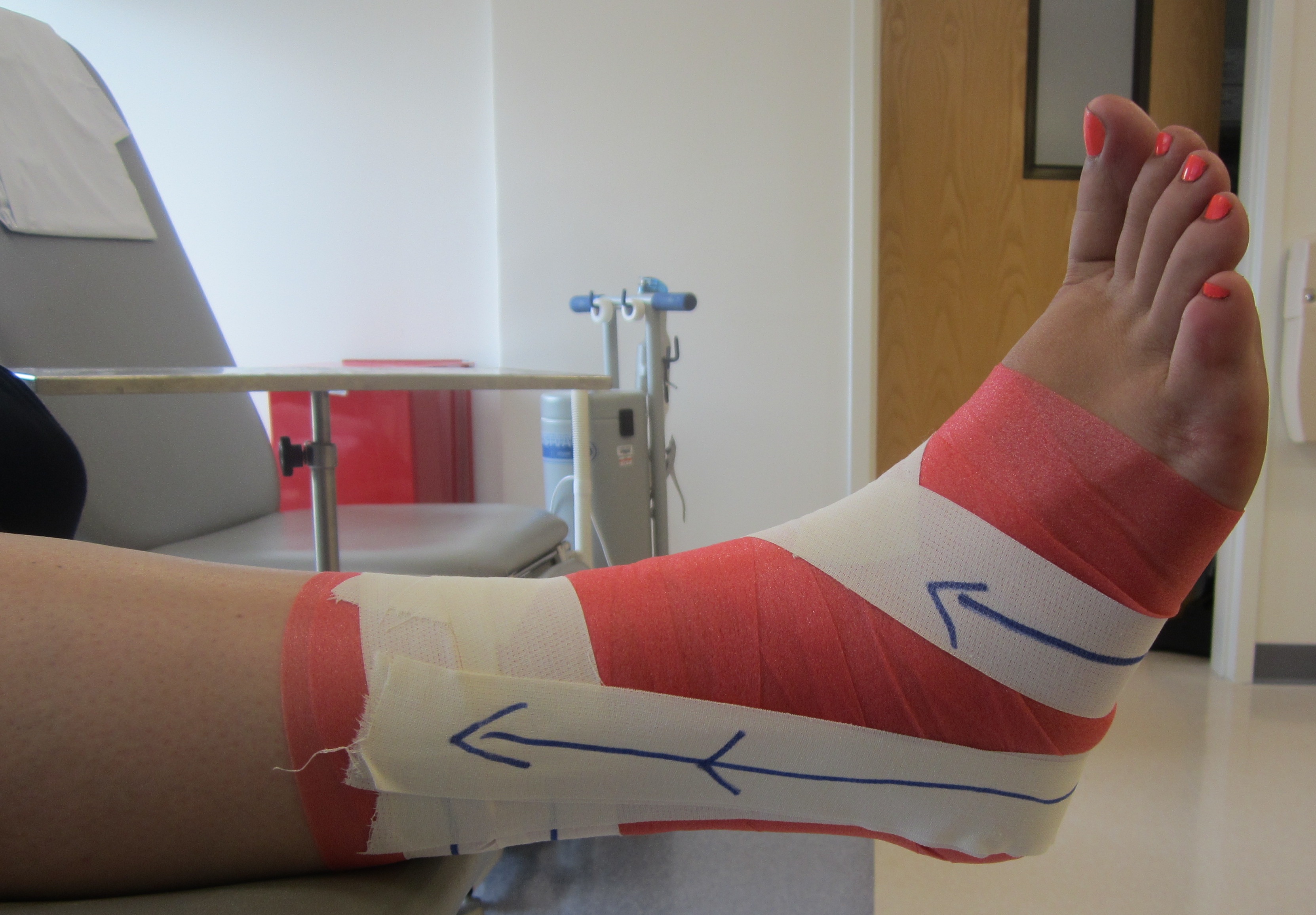 5b_Ankle_Taping_Stirrup-(Lateral)_8.12.14-2.JPG