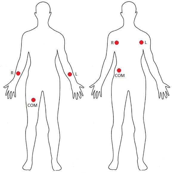 AD8232-Electrode-Placement-1.jpg