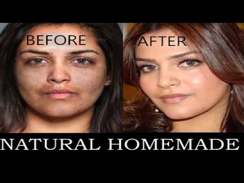 Amazing Skin Lightening Homemade Formula | Get Whiten Skin From Dark In 5 days Power of Makeup