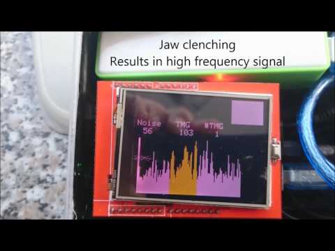 Arduino TMG measurement  MOVuseTMG text