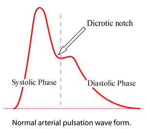 Arterial-Pulsation-Wave-Form_WEB2.jpg