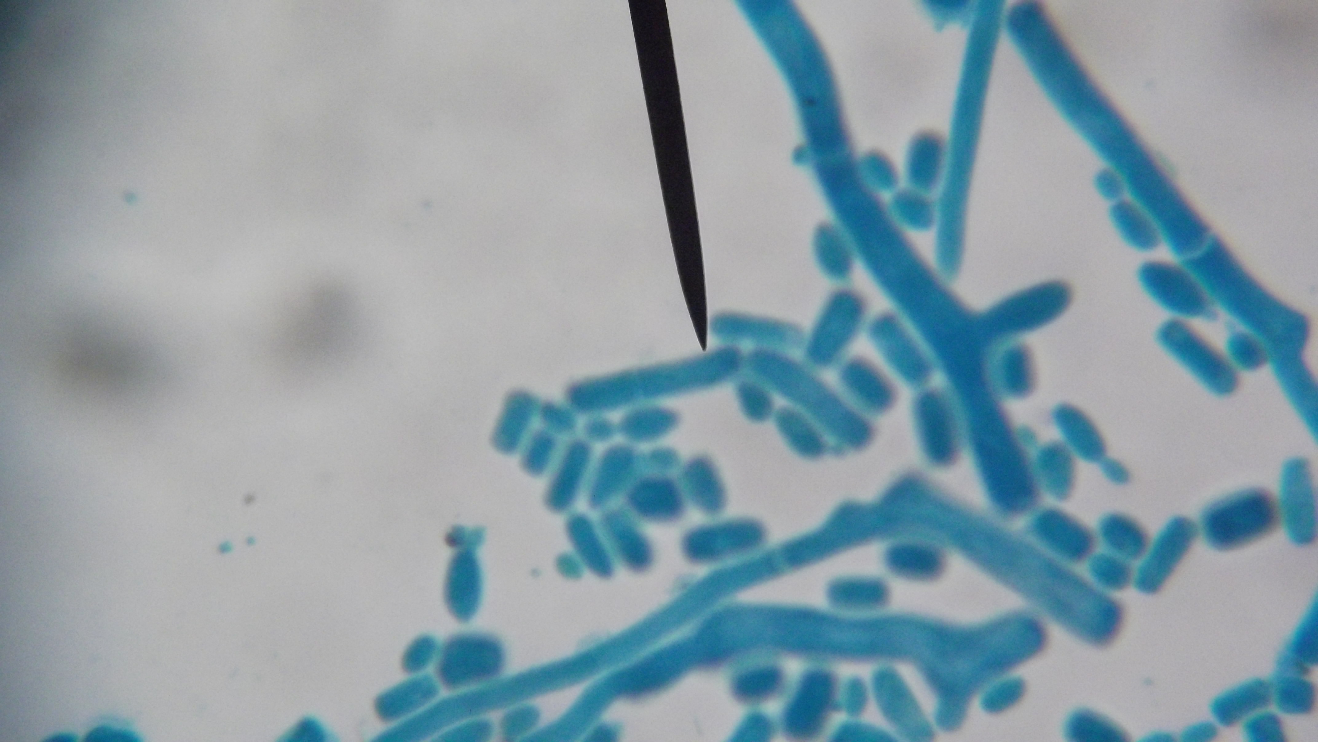 Bacteria fungi under dye Indigo carmine.JPG