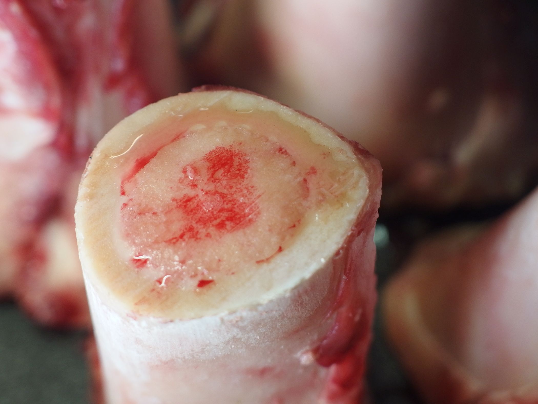 Bone Marrow04.jpg