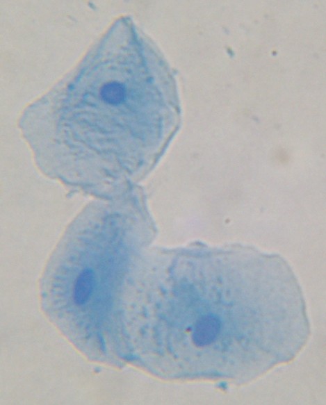 Cheek cells.JPG