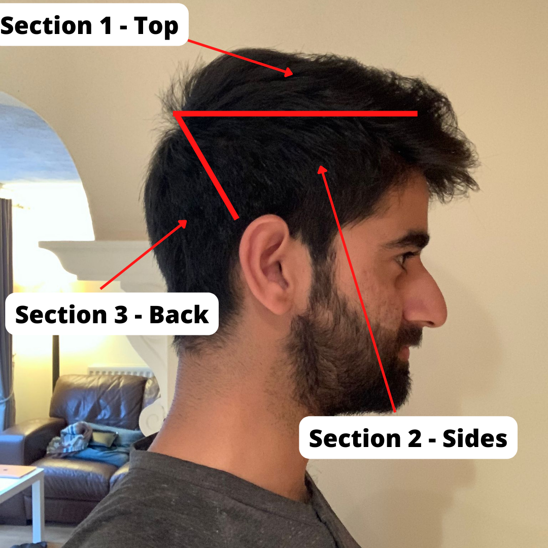 Copy of HOW TO FIX A PULLED MUSCLE OR STRAIN (7).png