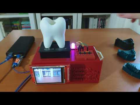 Data collection | AI-driven Dental Cast (Model) Classifier w/ Edge Impulse