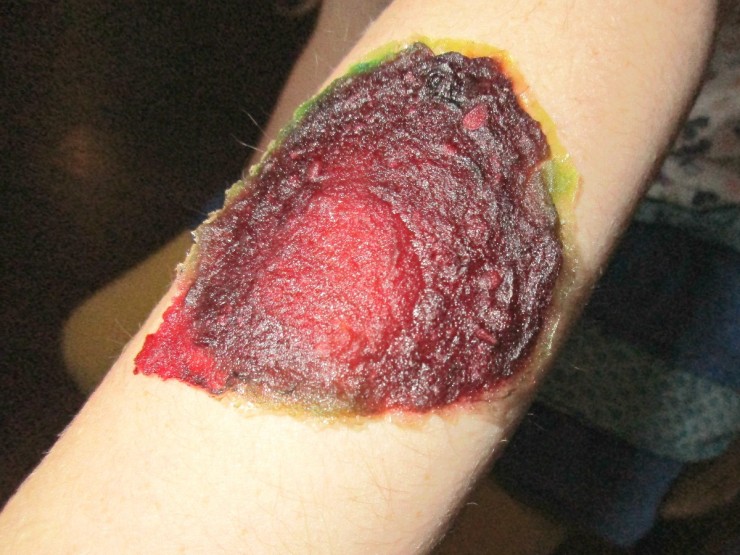 Disgusting-Edible-Scab-on-arm-740x555[1].jpg