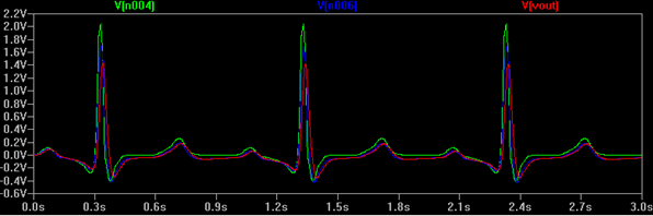 ECG Full.png