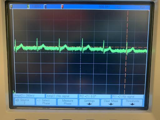 ECG Output.jpg