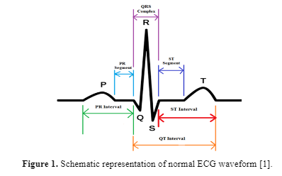 ECG general.PNG