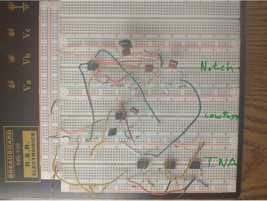 ECG with components labeled.jpg