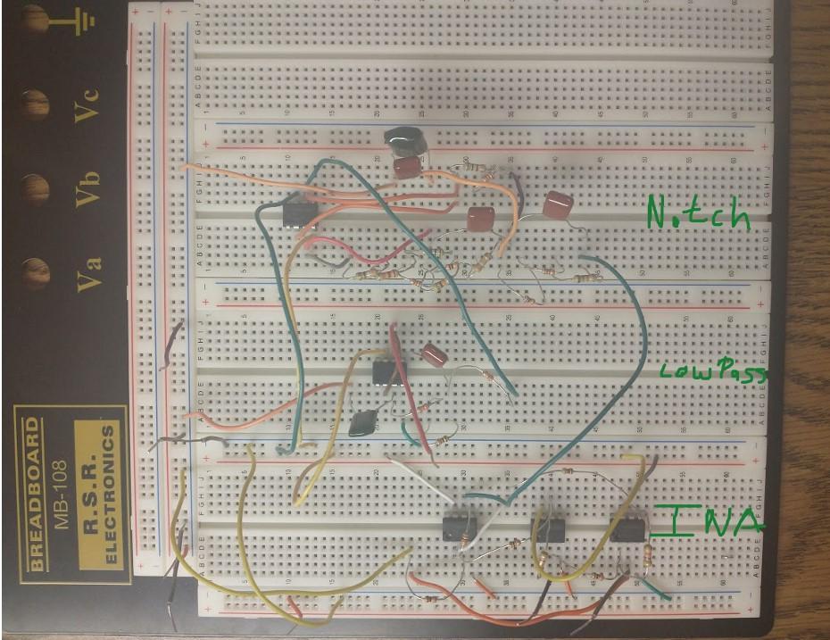 ECG with components labeled.jpg