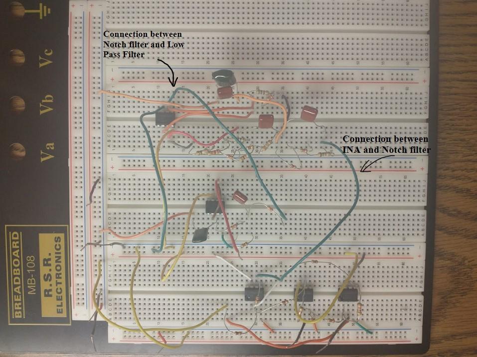 ECG with connections labeled.jpg