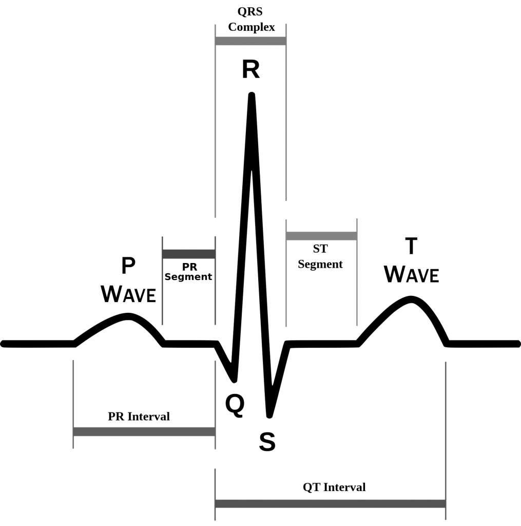 ECG-signal.png