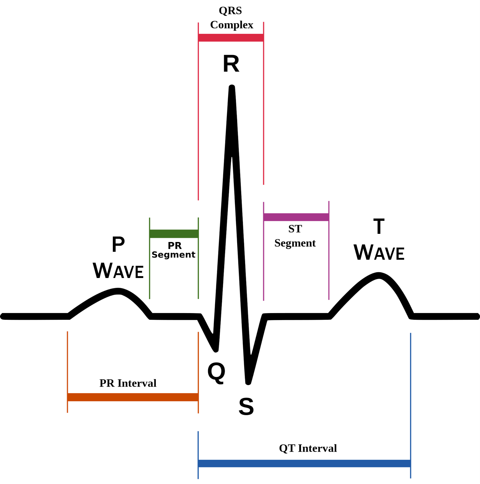 ECG.png