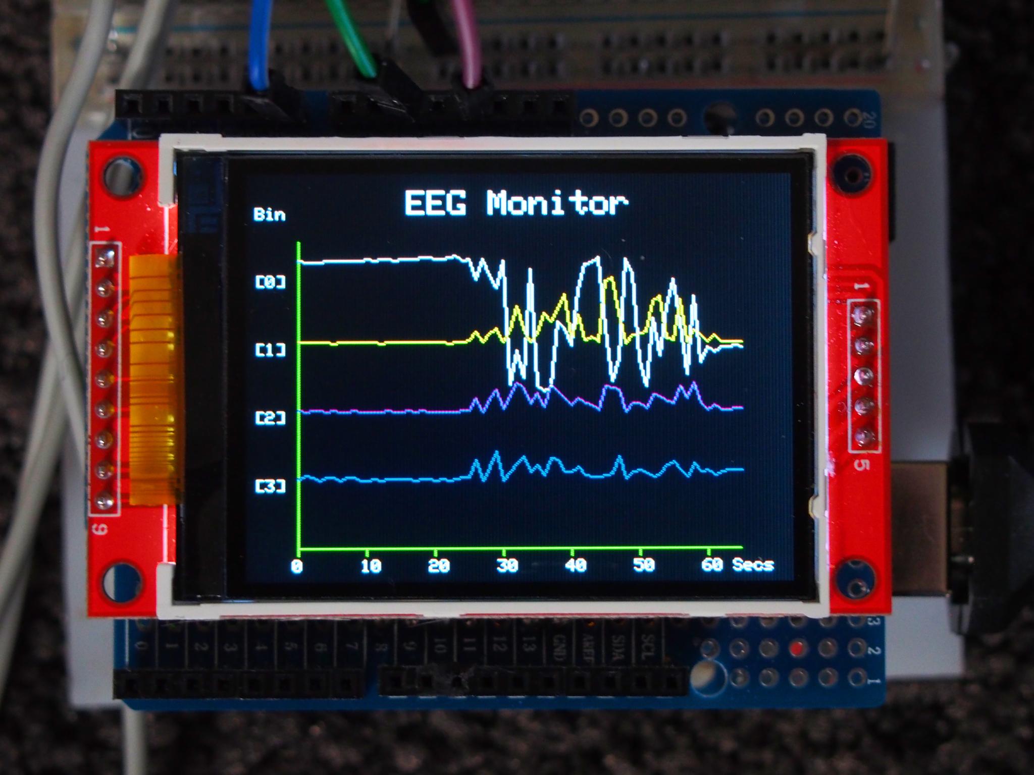 EEG_monitor_2.jpg