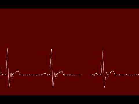 EKG sim