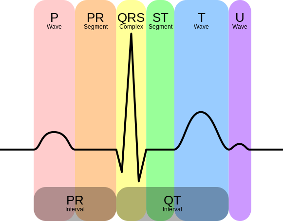 EKG_Complex_en.svg_.png