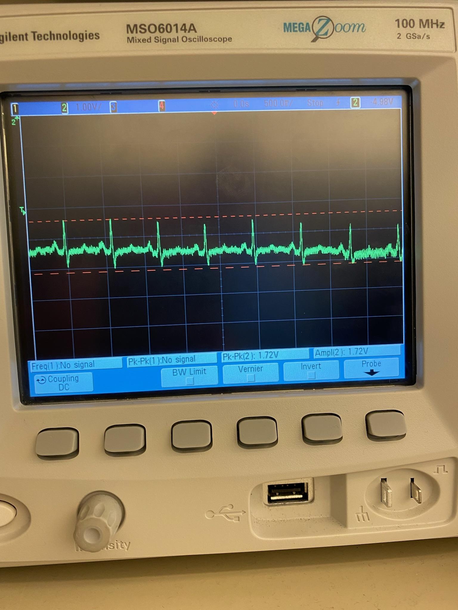 Emma ECG.jpg