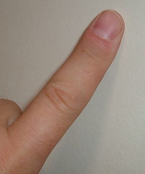 Finger.jpg