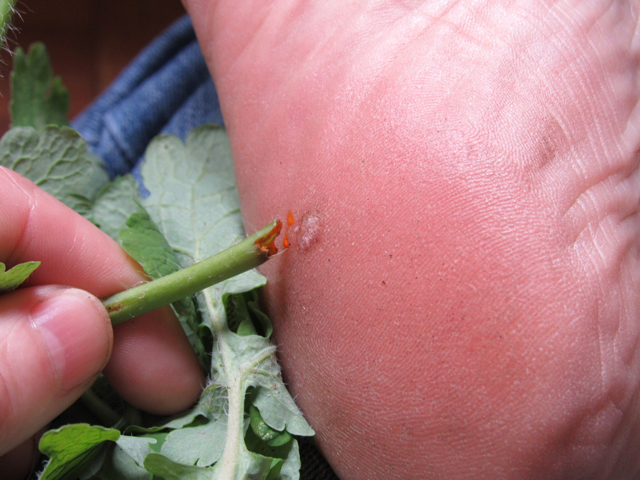 Greater Celandine sap for warts.jpg