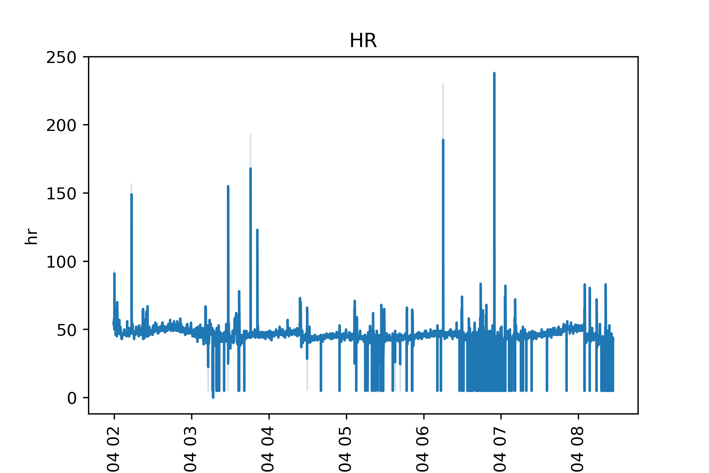 HR-LogstWithDowntime.png