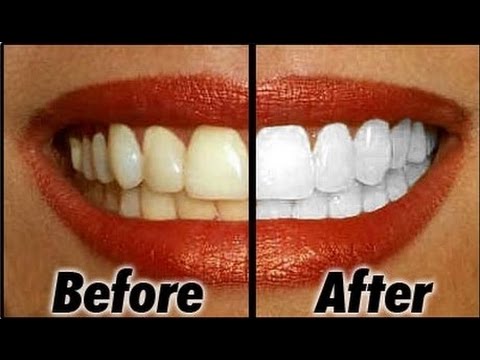 How To Have Natural White Teeth in 2 minutes