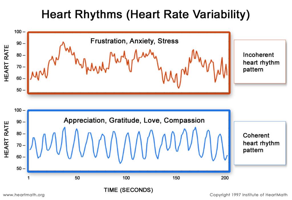 IP_Heart-Rhythm-graph-1024x701.jpg