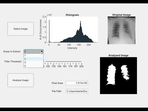 MatLab Lung Segmentation