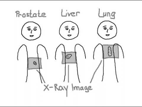 Motion in Prostate, Liver and Lung