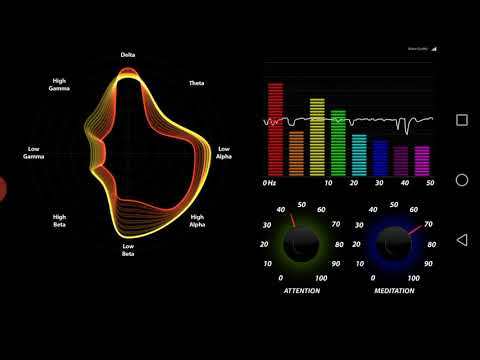 My BrainVisualizer