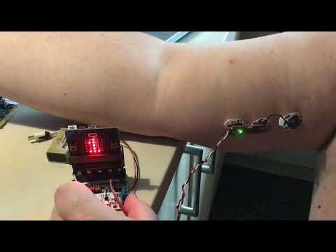 Myoware muscle sensor and microbit