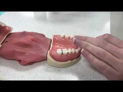 Placing &amp;amp; Removing Elastic Separators